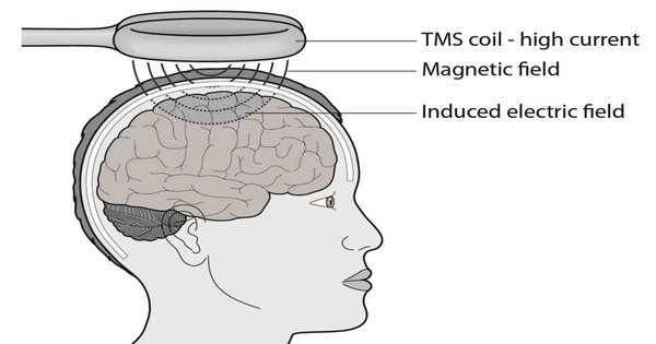 Design for Transcranial Magnetic Stimulation Targets Deeper Brain Regions