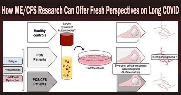 How ME/CFS Research Can Offer Fresh Perspectives on Long COVID