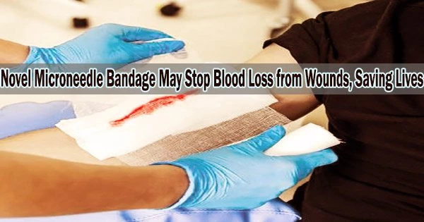 Novel Microneedle Bandage May Stop Blood Loss from Wounds, Saving Lives