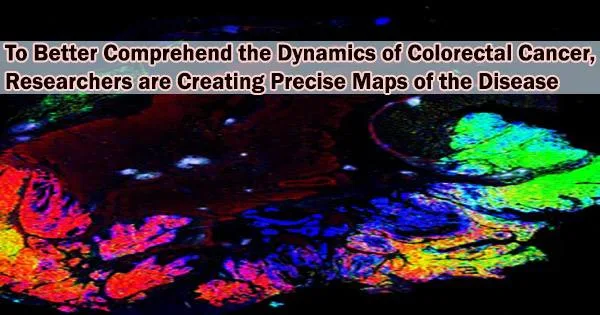 To Better Comprehend the Dynamics of Colorectal Cancer, Researchers are Creating Precise Maps of the Disease