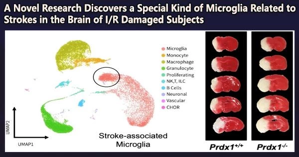 A Novel Research Discovers a Special Kind of Microglia Related to Strokes in the Brain of I/R Damaged Subjects