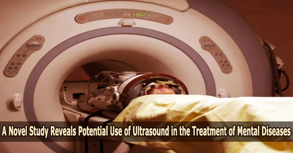 A Novel Study Reveals Potential Use of Ultrasound in the Treatment of Mental Diseases