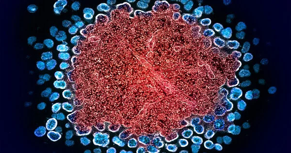HIV Reservoirs are Forming Sooner than Expected