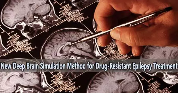 New Deep Brain Simulation Method for Drug-Resistant Epilepsy Treatment