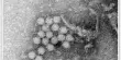 The Identification of a Circovirus implicated in Human Hepatitis