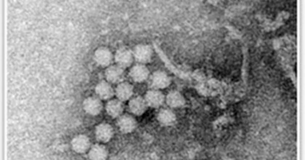 The Identification of a Circovirus implicated in Human Hepatitis