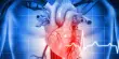 Women’s Reproductive Factors increase their risk of Cardiovascular Disease