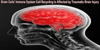 Brain Cells’ Immune System Cell Recycling Is Affected by Traumatic Brain Injury