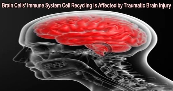 Brain Cells’ Immune System Cell Recycling Is Affected by Traumatic Brain Injury