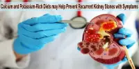 Calcium and Potassium-Rich Diets may Help Prevent Recurrent Kidney Stones with Symptoms