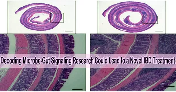 Decoding Microbe-Gut Signaling Research Could Lead to a Novel IBD Treatment