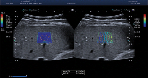 Elastography – a type of medical imaging