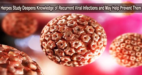Herpes Study Deepens Knowledge of Recurrent Viral Infections and May Help Prevent Them