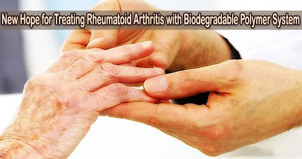 New Hope for Treating Rheumatoid Arthritis with Biodegradable Polymer System