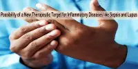 Possibility of a New Therapeutic Target for Inflammatory Diseases like Sepsis and Lupus