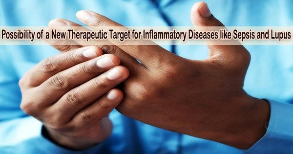 Possibility of a New Therapeutic Target for Inflammatory Diseases like Sepsis and Lupus