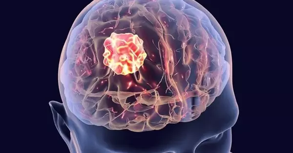 A Virus assisted in the Treatment of Glioblastoma