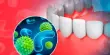Dentists discover new Bacterial Species linked to Tooth Decay