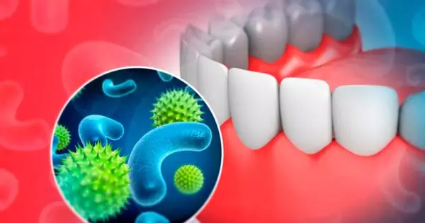 Dentists discover new Bacterial Species linked to Tooth Decay