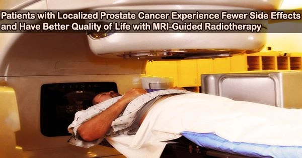 Patients with Localized Prostate Cancer Experience Fewer Side Effects and Have Better Quality of Life with MRI-Guided Radiotherapy
