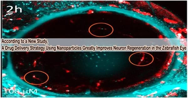According to a New Study, a Drug Delivery Strategy Using Nanoparticles Greatly Improves Neuron Regeneration in the Zebrafish Eye
