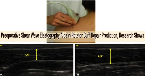 Preoperative Shear Wave Elastography Aids in Rotator Cuff Repair Prediction, Research Shows