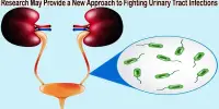 Research May Provide a New Approach to Fighting Urinary Tract Infections