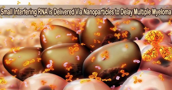 Small Interfering RNA is Delivered Via Nanoparticles to Delay Multiple Myeloma