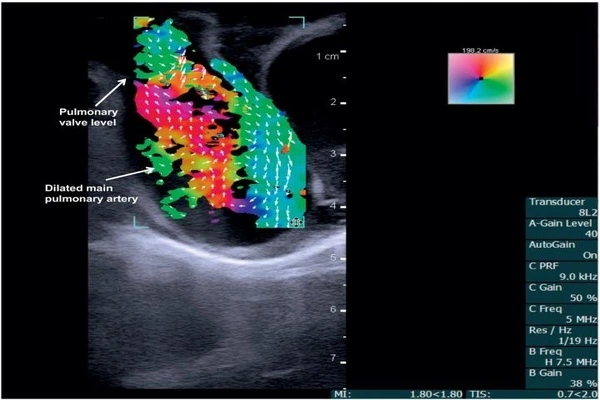 New ultrasound method could lead to easier disease diagnosis