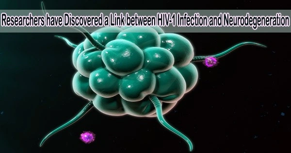 Researchers have Discovered a Link between HIV-1 Infection and Neurodegeneration