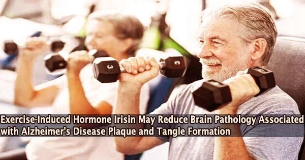 Exercise-Induced Hormone Irisin May Reduce Brain Pathology Associated with Alzheimer’s Disease Plaque and Tangle Formation