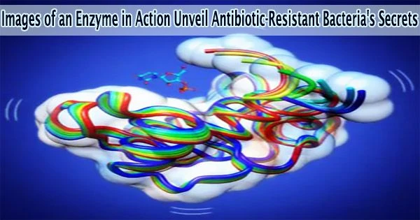 Images of an Enzyme in Action Unveil Antibiotic-Resistant Bacteria’s Secrets