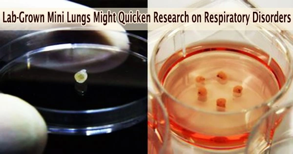 Lab-Grown Mini Lungs Might Quicken Research on Respiratory Disorders
