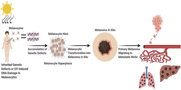 New insights into melanoma development and therapy