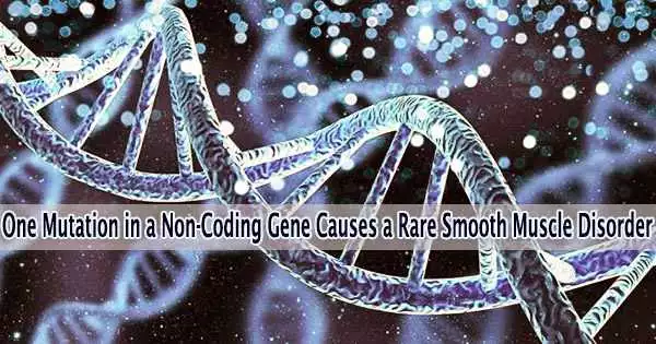 One Mutation in a Non-Coding Gene Causes a Rare Smooth Muscle Disorder
