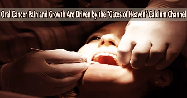 Oral Cancer Pain and Growth Are Driven by the “Gates of Heaven” Calcium Channel