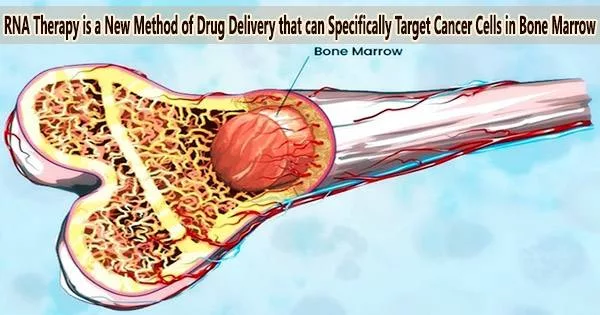 RNA Therapy is a New Method of Drug Delivery that can Specifically Target Cancer Cells in Bone Marrow