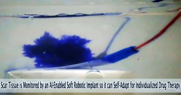 Scar Tissue is Monitored by an AI-Enabled Soft Robotic Implant so it can Self-Adapt for Individualized Drug Therapy