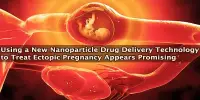 Using a New Nanoparticle Drug Delivery Technology to Treat Ectopic Pregnancy Appears Promising