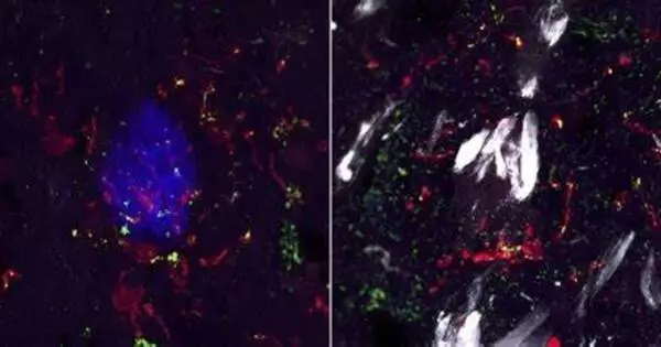 A Brain Inflammatory Marker has now been Identified