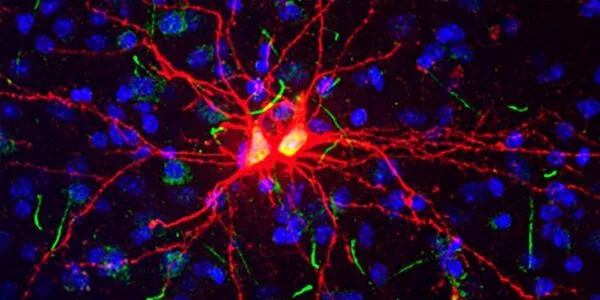 New biomarker predicts whether neurons will regenerate