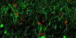 A New Biomarker can predict whether Neurons will Regrow