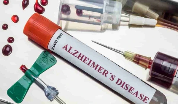 New blood test gives very high accuracy to screen for Alzheimer's disease