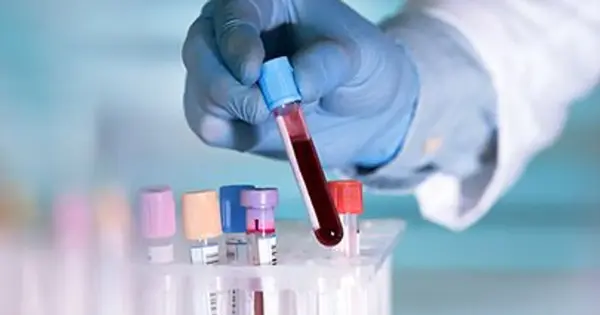 A New Blood Test for Alzheimer’s Disease has a High Level of Accuracy