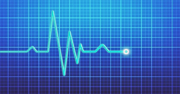AI can identify people with abnormal heart rhythms