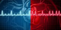 AI can Detect Persons with Irregular Cardiac Rhythms