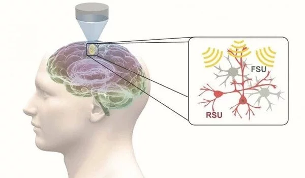 Targeted ultrasound can change brain functions for up to an hour after intervention