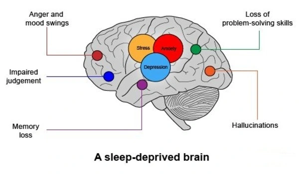 How sleep deprivation can harm the brain