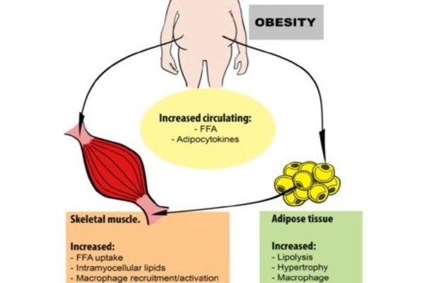 Exercise and muscle regulation: Implications for diabetes and obesity