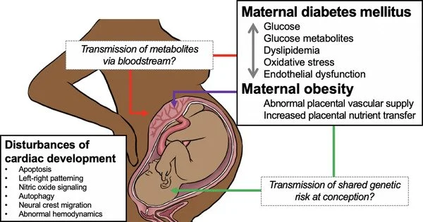 Maternal obesity predicts heart disease risk better than pregnancy complications